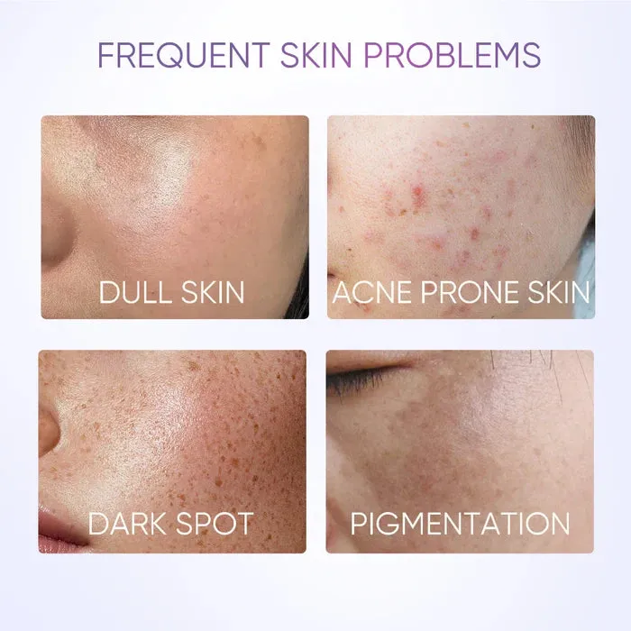 SymWhite 377 Dark Spot Serum 20ml